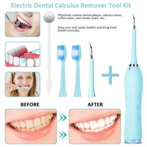 high-frequency tooth cleaner